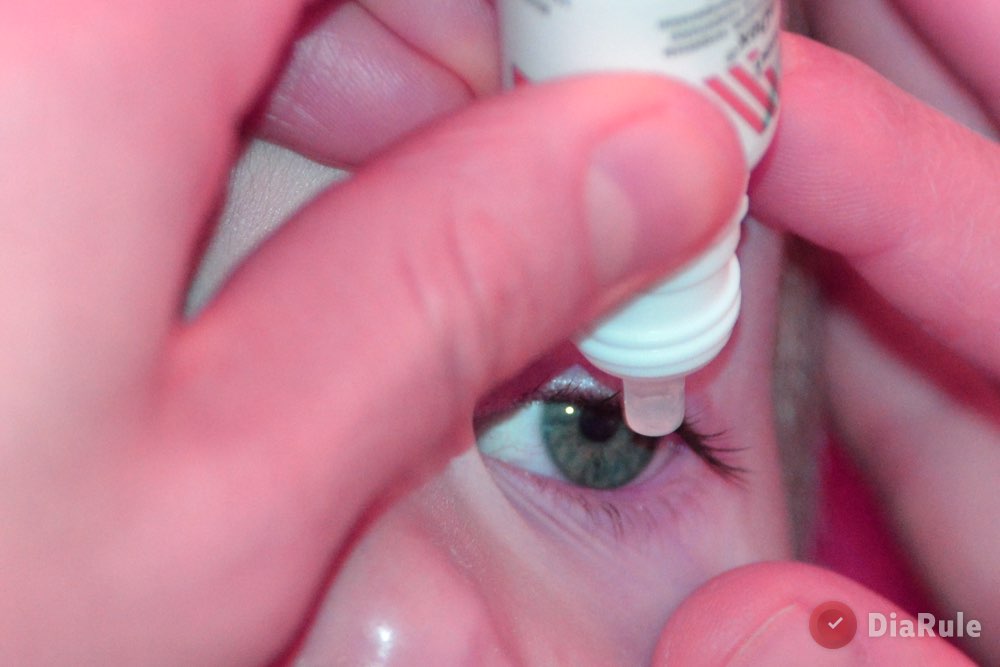 Лечение глазными каплями при диабете II типа